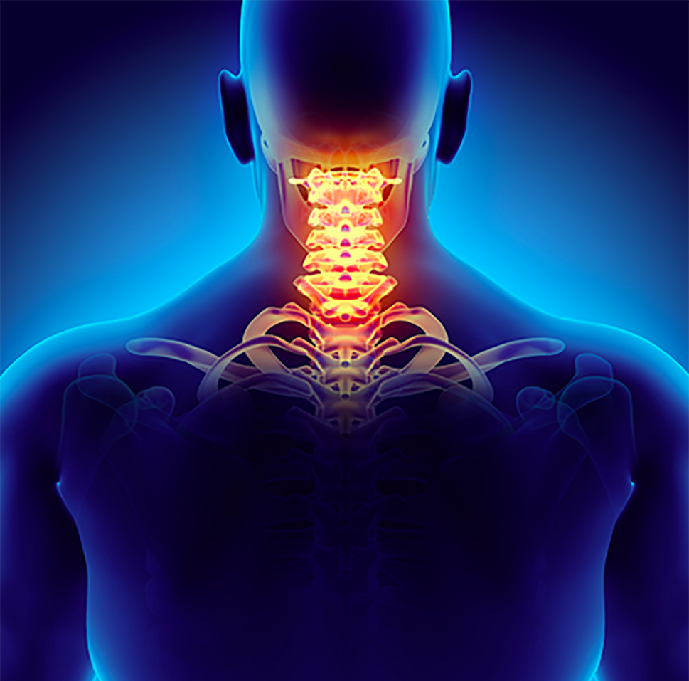 3D illustration of a cervical spine